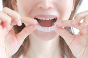 マウスピースの装着